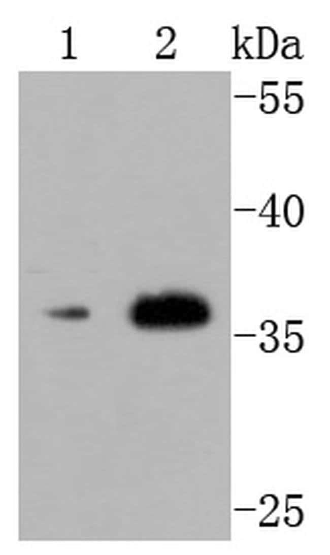 CD154 (CD40 Ligand) Recombinant Rabbit Monoclonal Antibody (JM11-34)