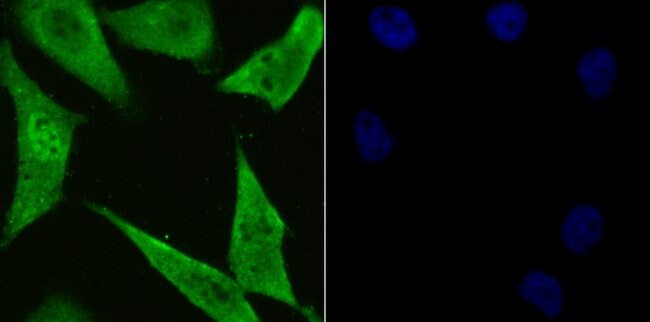 PSMA1 Recombinant Rabbit Monoclonal Antibody (JU66-24)
