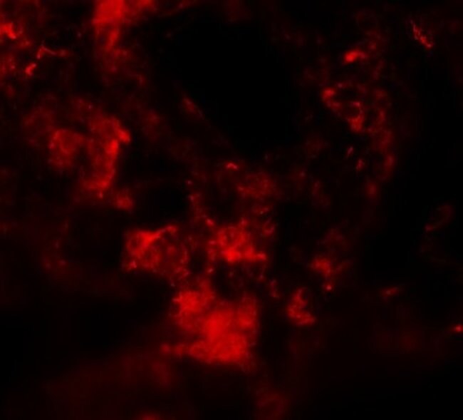 MFSD2A Polyclonal Antibody