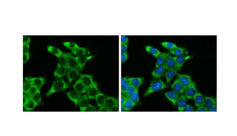 SFRP2 Polyclonal Antibody