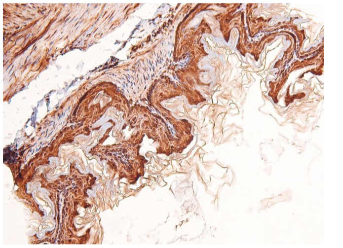 Phospho-LRP1 (Ser4520) Polyclonal Antibody