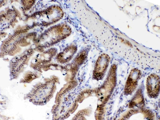 ETV6 Polyclonal Antibody