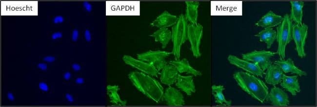 GAPDH单克隆抗体（GA1R）,内参