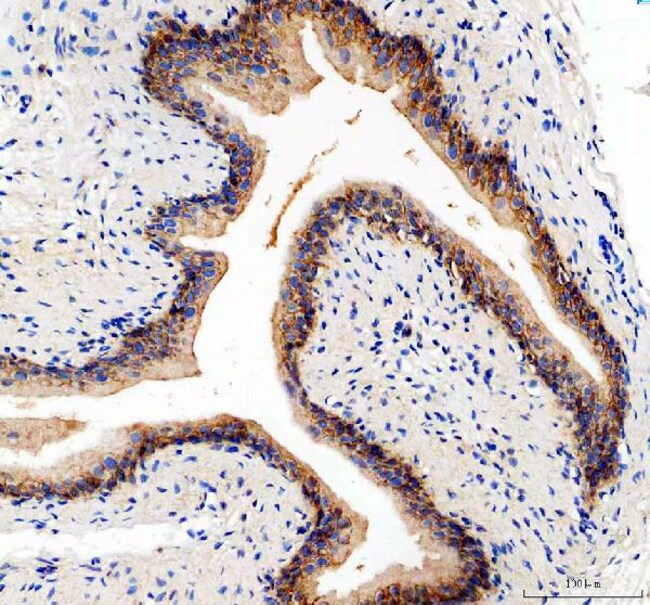 CD49e (Integrin alpha 5) Polyclonal Antibody