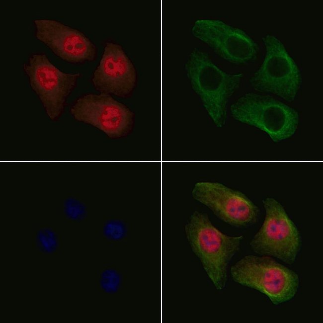 Phospho-Cdc25A (Ser178) Polyclonal Antibody