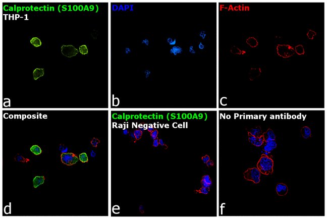 Calprotectin Monoclonal Antibody (MAC387)