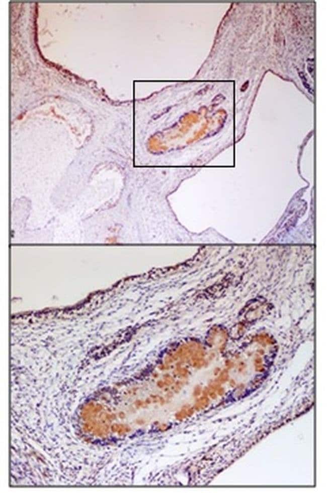VMAT2 Polyclonal Antibody