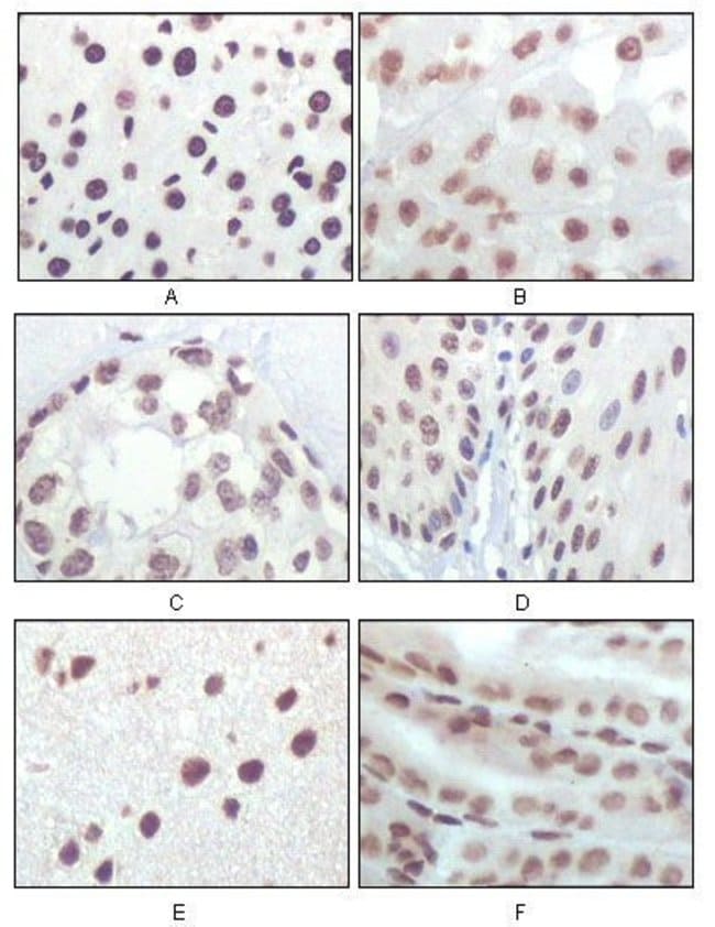 p16INK4a Monoclonal Antibody...