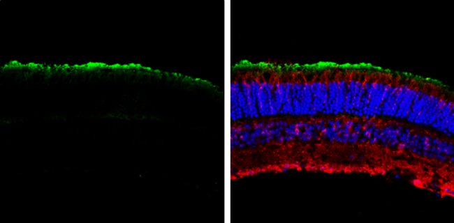 GNAT1 Polyclonal Antibody