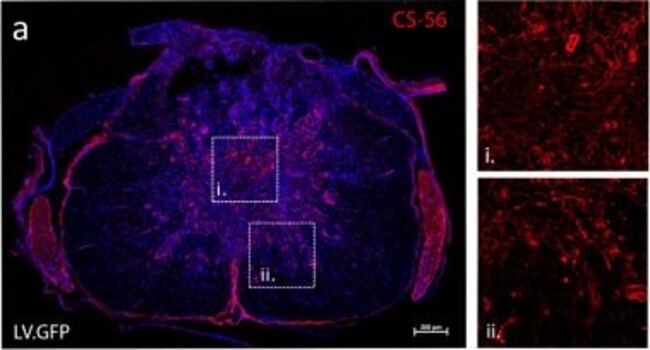 Goat anti-Mouse IgM (Heavy chain) Cross-Adsorbed Secondary Antibody, Alexa Fluor 568