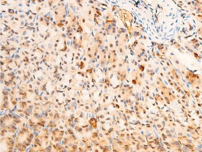 Phospho-PDPK1 (Ser241) Polyclonal Antibody