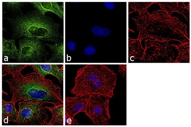 alpha Tubulin Monoclonal Antibody (YL1/2)
