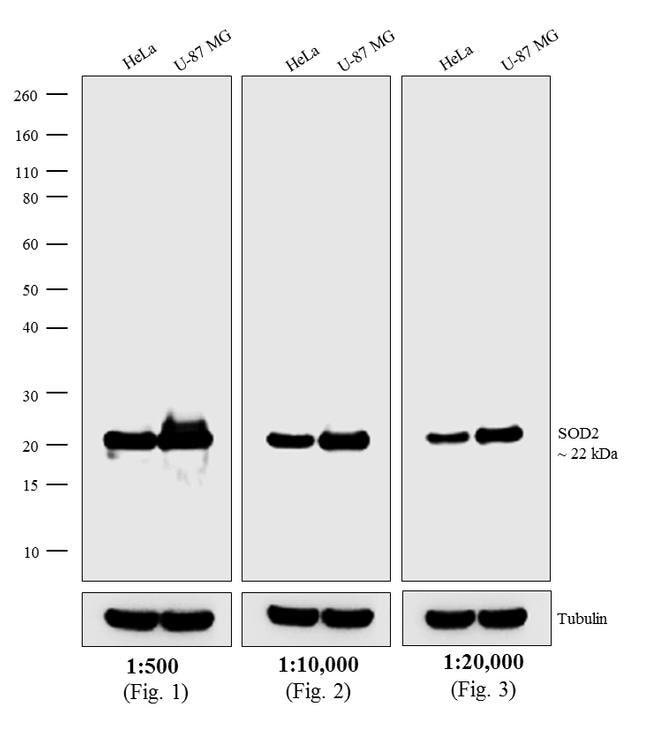 Donkey anti-Mouse IgG (H+L) Highly Cross-Adsorbed Secondary Antibody, HRP