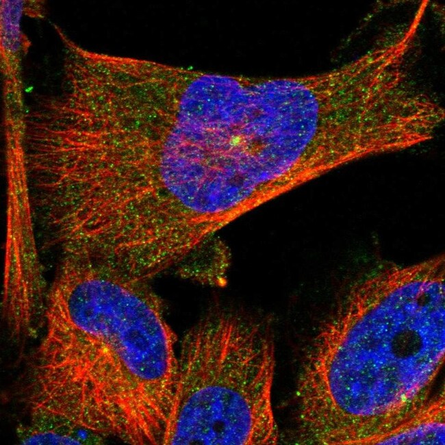 TMEM63C Polyclonal Antibody