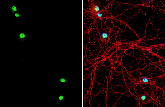 LIM1 Polyclonal Antibody