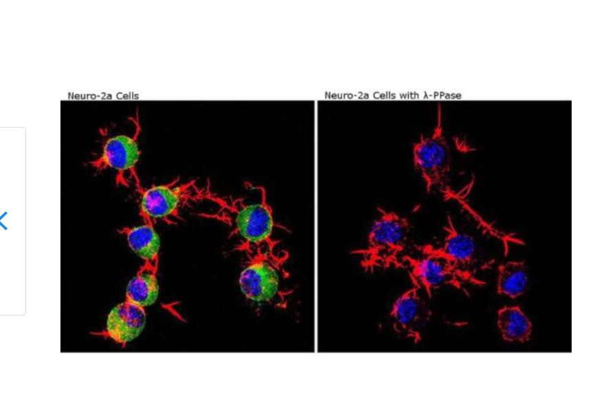 Phospho-CaMKII alpha (Thr286) Monoclonal Antibody (22B1)