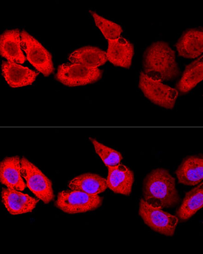 S100A8 Polyclonal Antibody