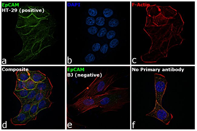 EpCAM Monoclonal Antibody (323/A3)
