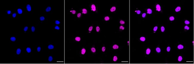 PCYT1A Recombinant Rabbit Monoclonal Antibody (24GB5015)