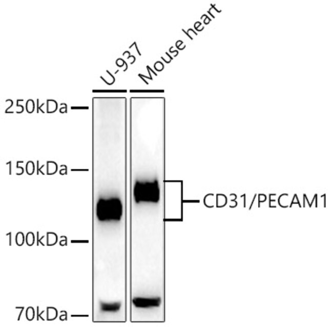 CD31 (PECAM-1) Recombinant Rabbit Monoclonal Antibody (2V8C4)