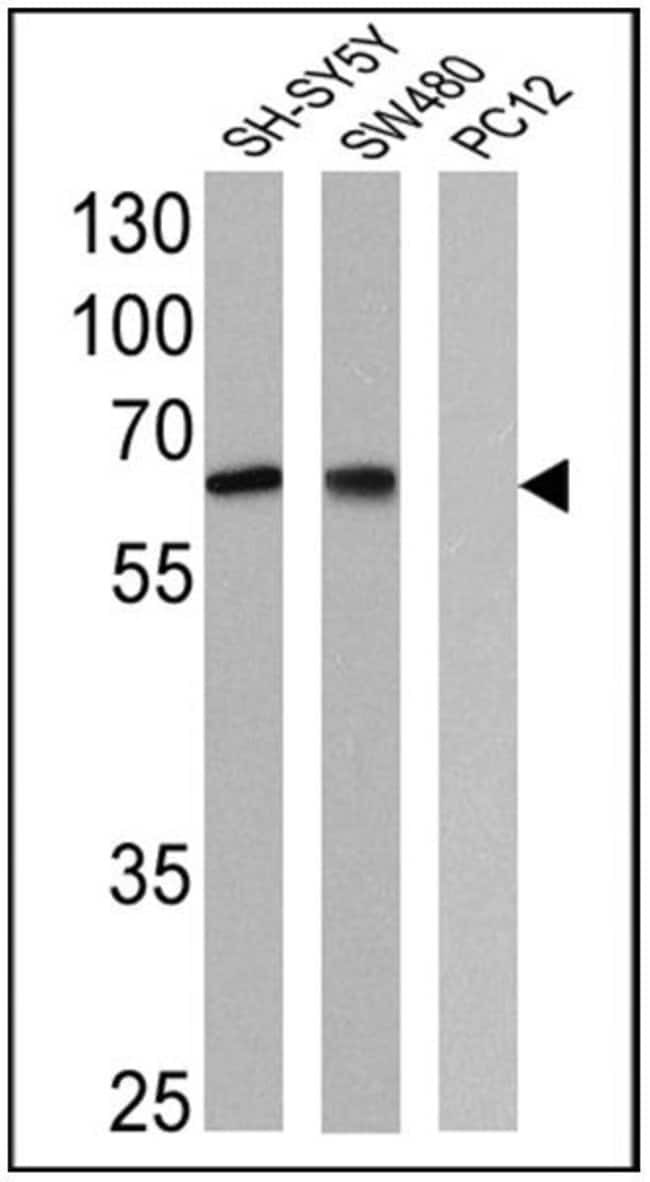 NGFR Monoclonal Antibody (NGFR5)