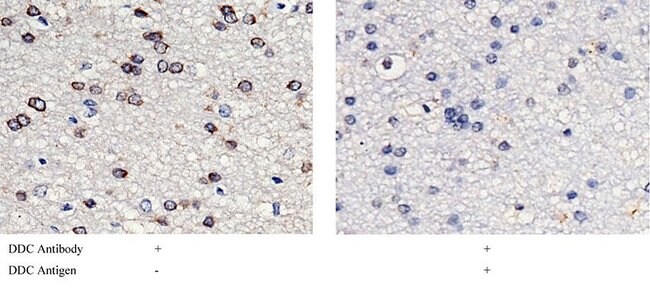 DOPA Decarboxylase Recombinant Rabbit Monoclonal Antibody (005)