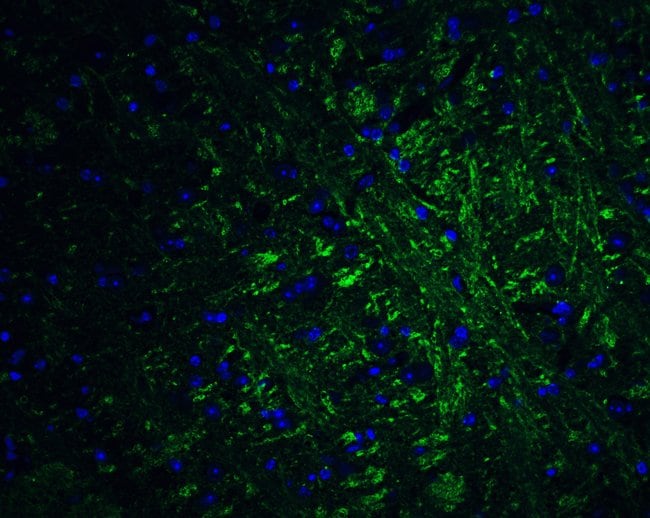 PRDM16 Polyclonal Antibody