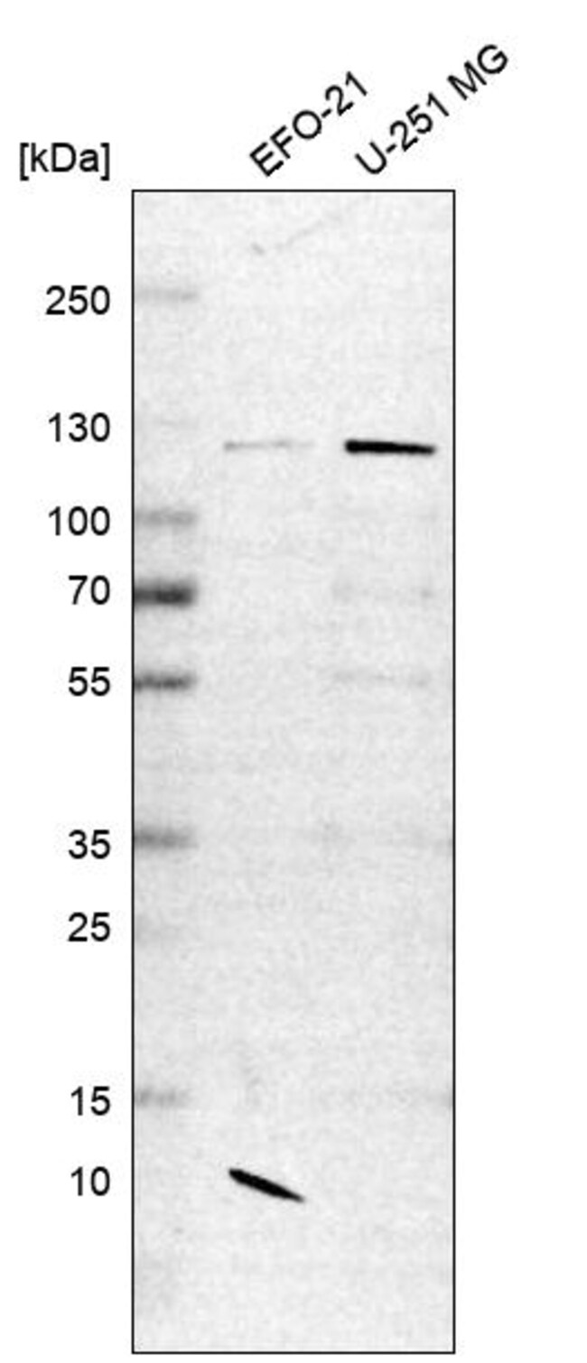 CHD1L Polyclonal Antibody