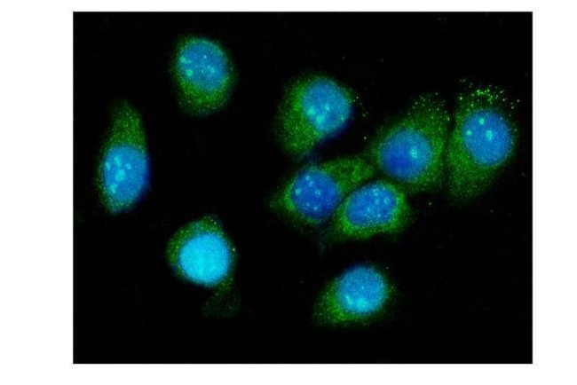 Galectin 3 Polyclonal Antibody