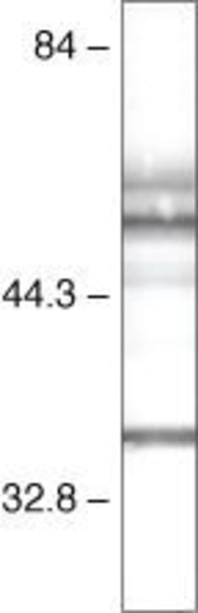 PAX2 Polyclonal Antibody