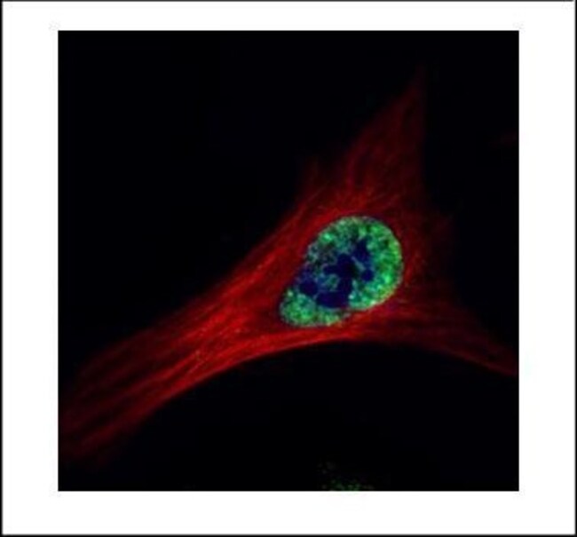 ETS2 Polyclonal Antibody