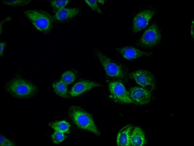 QDPR Polyclonal Antibody