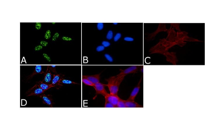 Phospho-Tau (Thr231) Polyclonal Antibody