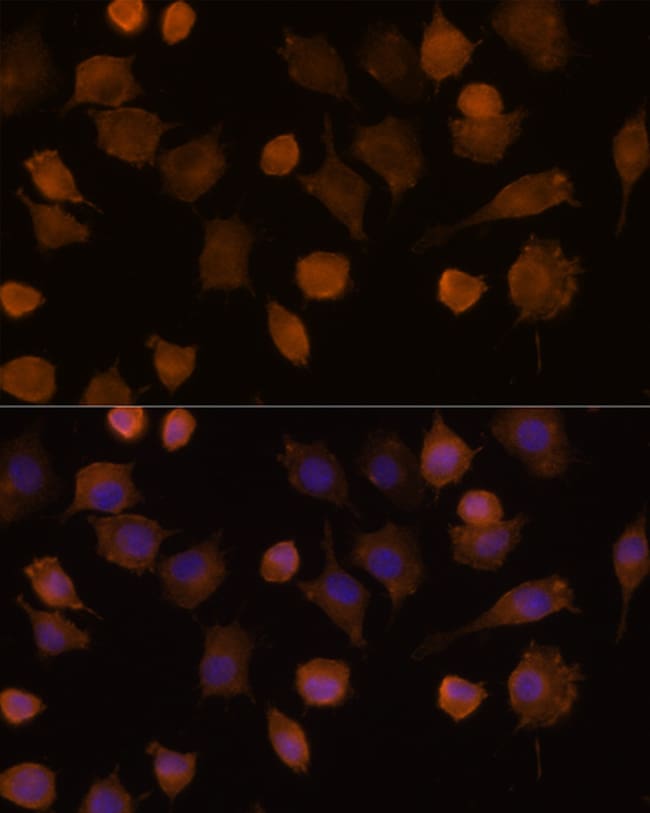 ICAM-1 Polyclonal Antibody