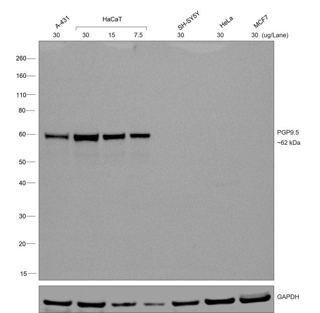 Goat anti-Mouse IgG1 Secondary Antibody, HRP