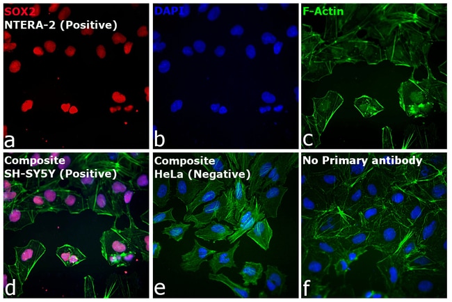 Goat anti-Rat IgG (H+L) Highly Cross-Adsorbed Secondary Antibody, Alexa Fluor Plus 555