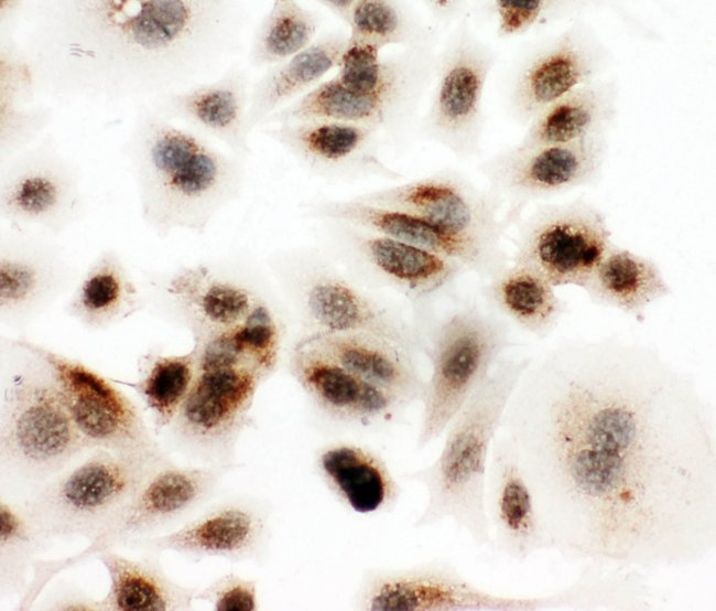 DDX4 Polyclonal Antibody