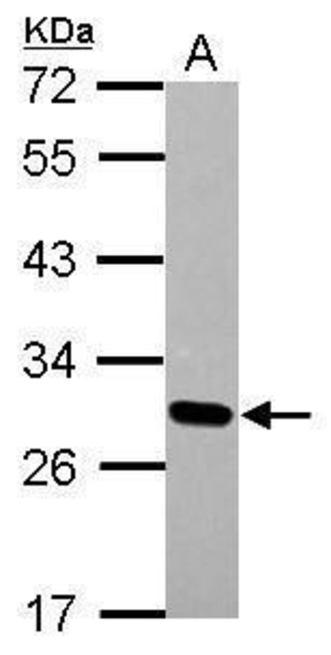 DLX1 Polyclonal Antibody