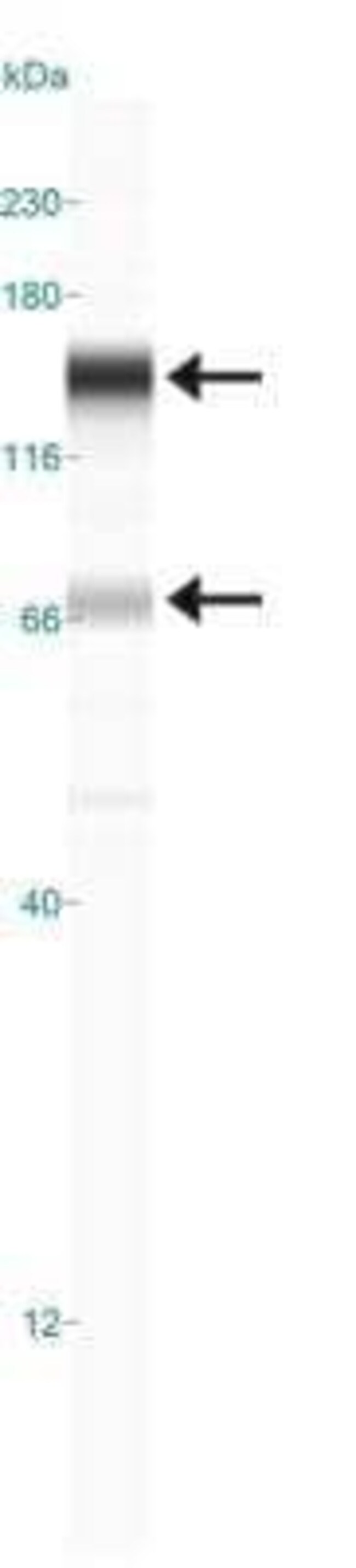 RAD21 Monoclonal Antibody (CM110-2C10)