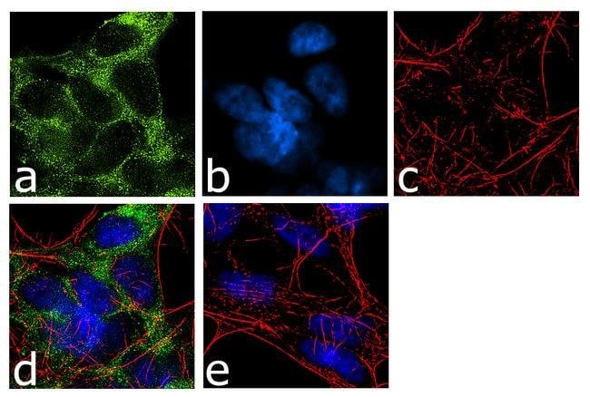 SLC6A4 Recombinant Rabbit Monoclonal Antibody (16H2L7)