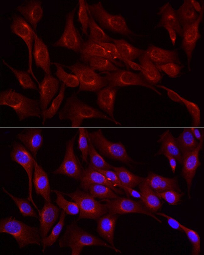 LDLR Polyclonal Antibody