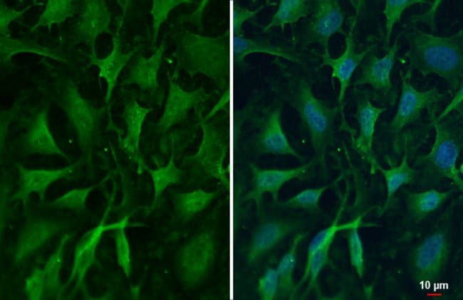 ZC3H12A Polyclonal Antibody