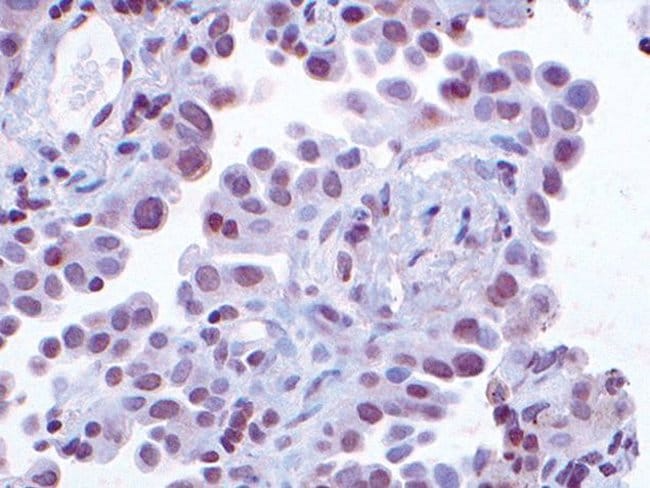 CKS1 Polyclonal Antibody