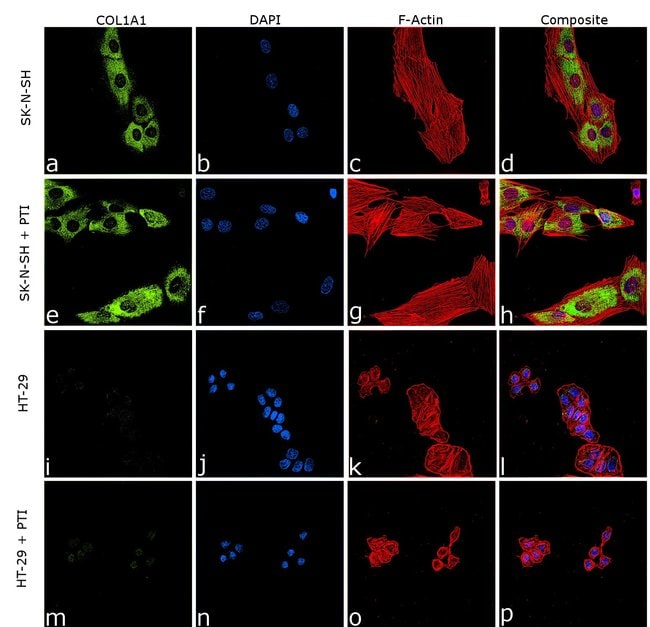 COL1A1 Polyclonal Antibody