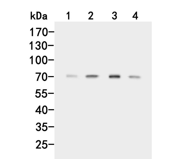 ACVR2A Polyclonal Antibody