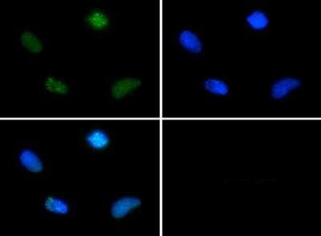 Phospho-Survivin (Thr34) Polyclonal Antibody