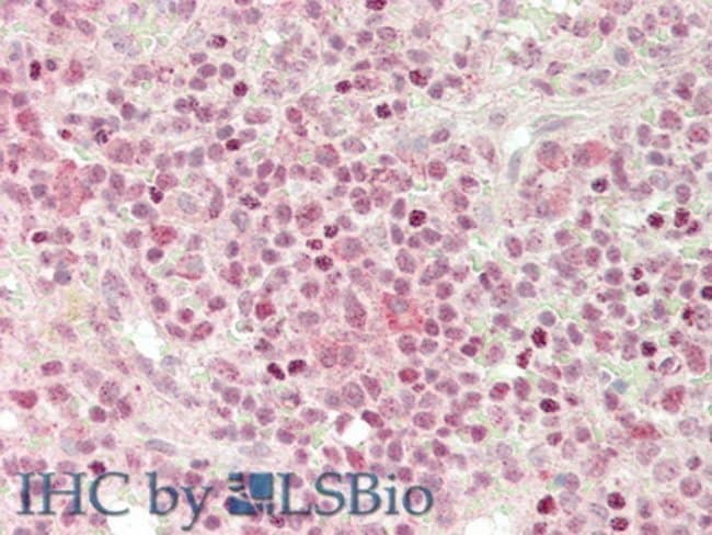 CXCL2 Polyclonal Antibody
