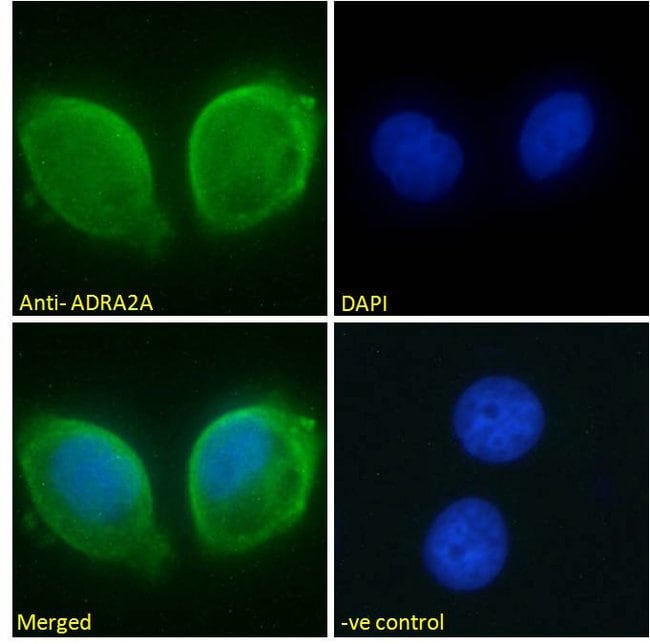 alpha-2a Adrenergic Receptor Polyclonal Antibody