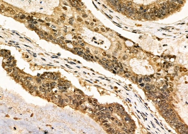 Phospho-FOXO1 (Ser256) Polyclonal Antibody