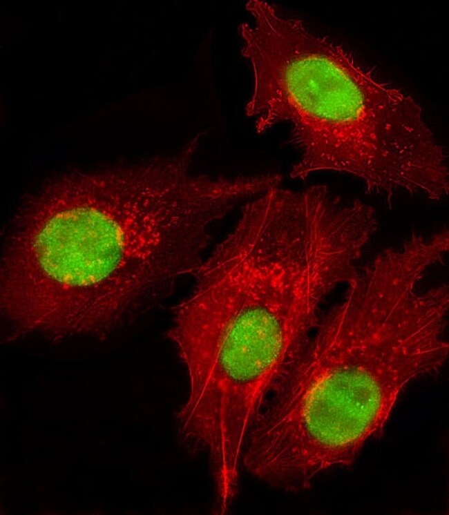 FOXD1 Polyclonal Antibody